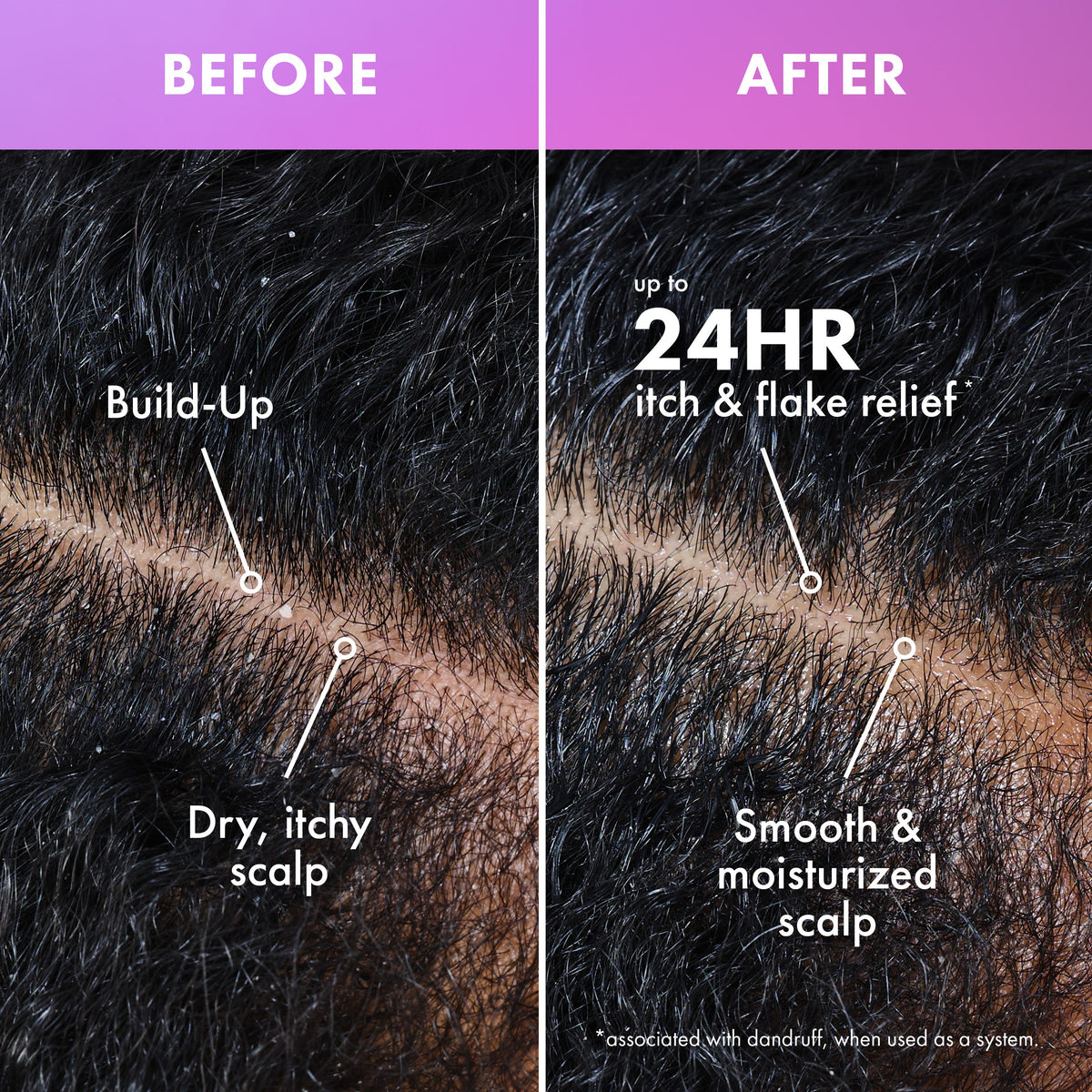 Lavender & Lychee Scalp & Hair Build Up Remover
