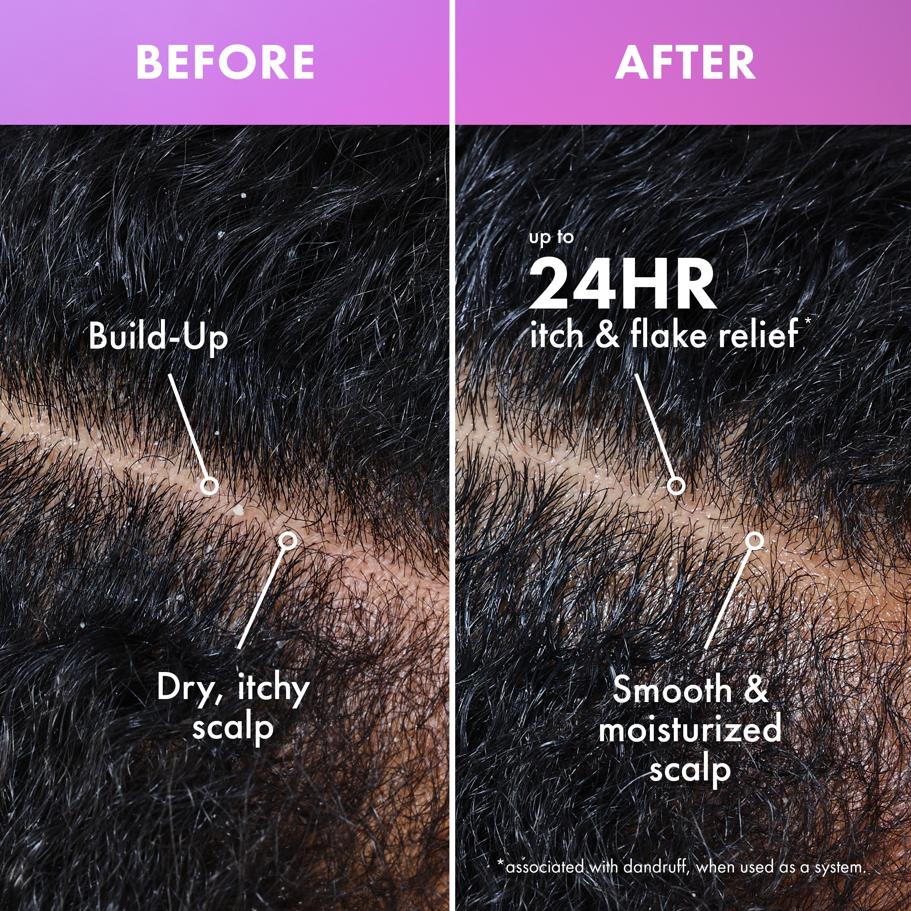Lavender & Lychee Daily Scalp Moisturizing Lotion